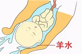 子宫的大门松了图片