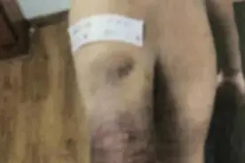 狠毒！情侣打小学生！受托照看作业辅导，做错题拿戒尺打了1500下图片