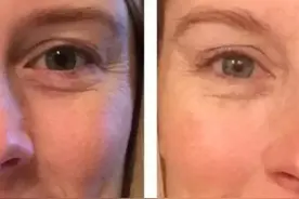 每天喝3升水，坚持1个月会发生什么？图片