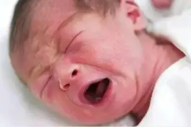 新生儿常见若干问题及解决办法|实用篇图片