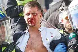 暴乱之火烧到伦敦，英国白人至上流氓组织与反种族主义者爆发冲突图片