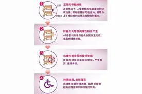 强直性脊柱炎会导致残疾！做对这些事情，可以给疾病进程“减速”图片
