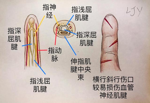指腹:位于屈肌腱两侧,肌腱断裂时容易同时伤及.