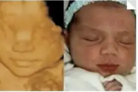 四维中的胎儿和生出来的胎儿，会一样吗？过来人：实物和图片不符图片