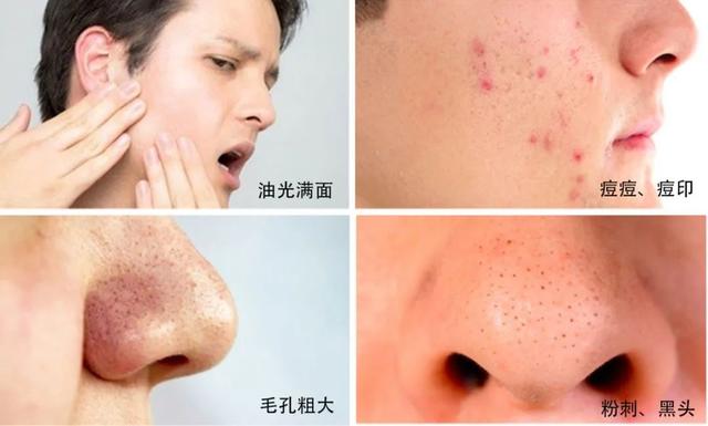 为什么脸越洗越粗糙？因为你没用对方法