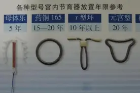 绝经妇女节育环要不要取？什么时候取？图片