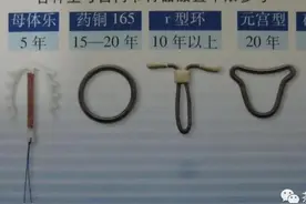 绝经妇女节育环要不要取？什么时候取？图片
