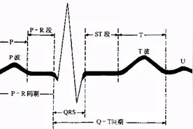 掌握常见心电图，我的心脏我做主图片