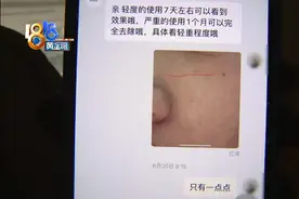 买抑菌套装点痣，身上留下疤痕图片