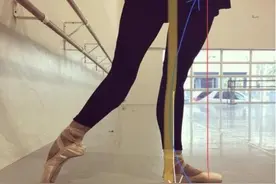 超过一半人都有的“膝超伸”，腰肥腿粗！快看你中招了没？图片