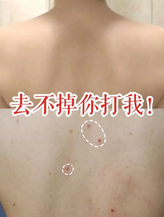 泡完脚能涂身体乳吗
