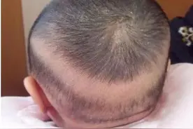 新生宝宝可能出现的一些小问题，知道了不必紧张图片