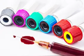 我是职业“试药人”，靠药物试验获得收入，我的工作是什么样的？图片