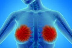 乳腺彩超优缺点讲解，适用人群也很广泛图片