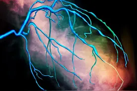 检查心脏血管狭窄，是CT好，还是造影好！有什么区别，如何选择？图片