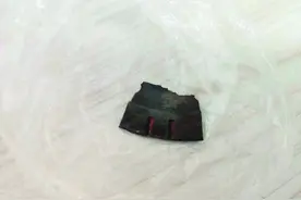 危急！电锯锯片崩裂，桂林一男子被割断颈部动脉图片