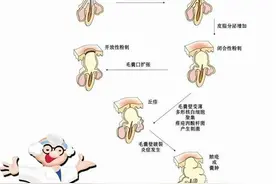长痘是因为脸没有洗干净导致毛孔堵塞引起的吗？图片