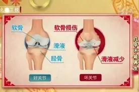 防治骨关节疾病，请吃“糖”图片