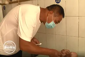 19岁男孩烧伤面积达50% 姐姐要辍学救人 妈妈哭得撕心裂肺图片