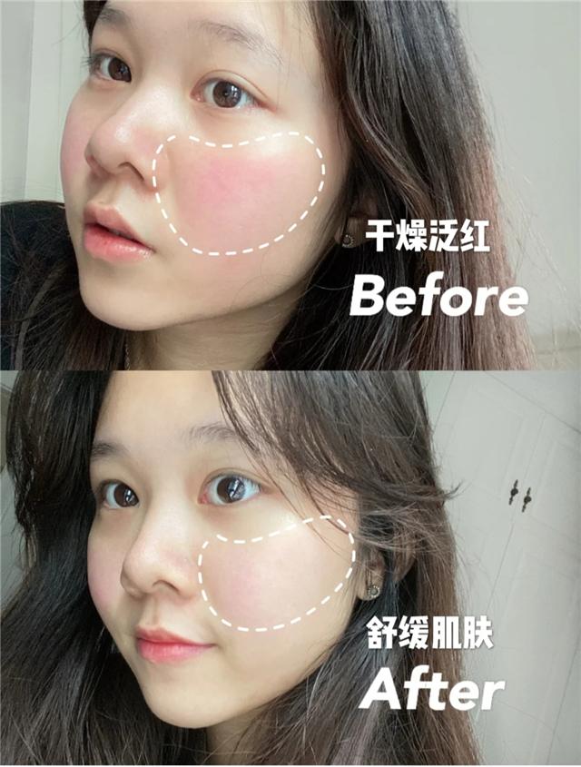 瞎洗脸，毁了多少女人的好皮肤！这种正确的洗脸方式你需要知道