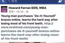 牛人！谁给你的勇气？竟然自己做牙齿矫正图片