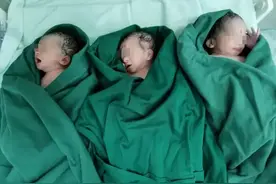 罕见！桂林妈妈生下3胞胎，几率堪比中彩票图片