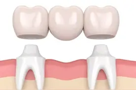 牙齿美白小技巧图片