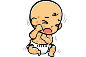 宝宝起疹子宝爸宝妈要警觉，4种疹子4种症状4种疗法，早看早安心图片