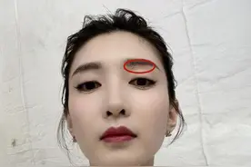 江疏影晒“死亡角度”自拍，却被指眉下有疤痕，与旧照对比差距大图片