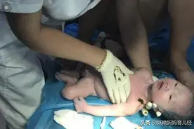 20岁女孩不知道怀孕，洗澡时孩子钻出了，还问医生：我怎么会怀孕图片