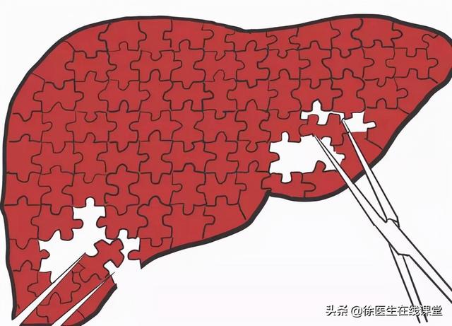 乙肝病毒携带者可以高枕无忧过日子？