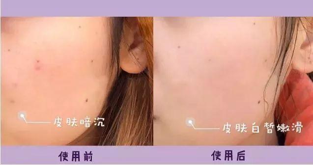 李佳琦带火的面膜，价格便宜被很多人忽略，提亮保湿效果想不到