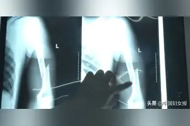 冲上热搜！大学生掰手腕，手臂断了......图片