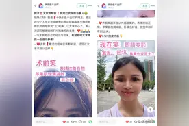 从果汁脸到凹坑怪人，花5万拉皮的我就这样毁容了…图片