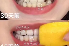 李佳琦的液体牙膏让我爱上刷牙！一口大黄牙变白，连呼气都是香的图片