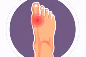 《欧洲内科杂志》发表新研究：尿酸高，寿命缩短11年图片