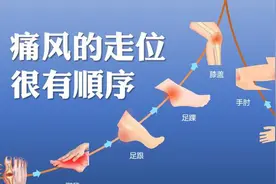 痛风不是腰痛，不是胸痛，不是头痛，是常见的关节疼痛图片