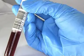 高血黏有哪些早期信号？图片