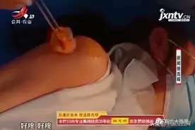 停车场起落杆划伤小孩 南昌莱蒙都会物业只愿担责30%图片