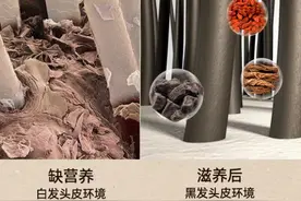 「精华」别乱用方法了，养发有奇方乌发方养出黑发，后悔没早知道图片