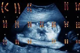 一旦发生过胚胎染色体异常，还能再要孩子嘛？图片