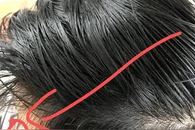 35岁山东女子，坚持用盐水洗头，一个月后，出现了哪些变化图片