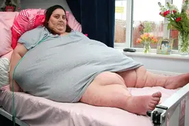 狂吃十年让胖妈器官衰竭，切胃减肥暴瘦66公斤，仍难逃死神索命图片