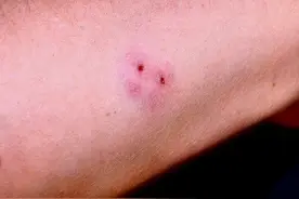 印度每年4.59万人死于蛇咬，耍蛇人仍乐此不疲，不怕死么？图片