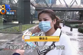 取耳软骨垫鼻尖，鼻子好了耳朵却变形了图片