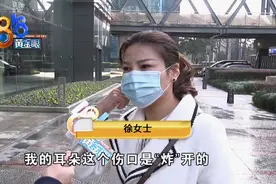 取耳软骨垫鼻尖，鼻子好了耳朵却变形了图片