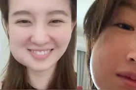 智齿拔不拔，疼不疼，拔牙费用，拔牙后影响，一次性说清楚图片