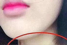 13岁女儿脖子上有“草莓”，父母逼问下了解实情，网友：太早熟了图片