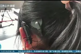 4岁女童丢失人工耳蜗外机 母亲急盼寻“耳朵”图片
