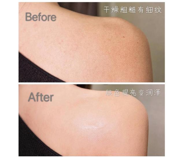 鸡皮肤是显性遗传吗